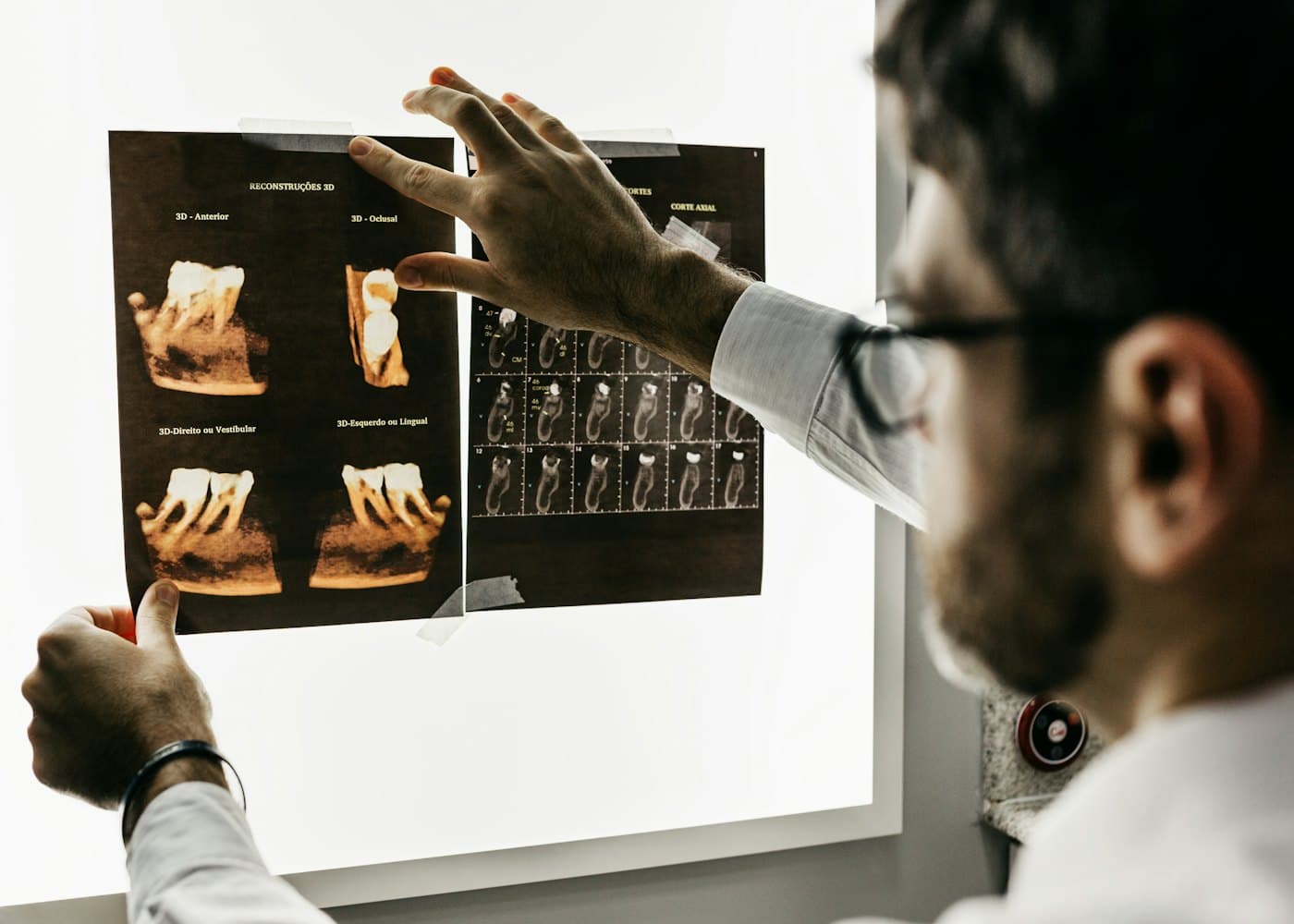 Doctor reviewing dental X-rays